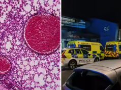 Surto de meningite dispara alarme depois que estudante morre e outras duas pessoas adoecem na área de Studying
