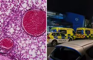 Surto de meningite dispara alarme depois que estudante morre e outras duas pessoas adoecem na área de Studying