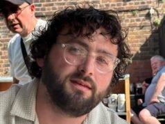 A estrela do Manchester do Gogglebox, Shaun Malone, 31, passa por uma cirurgia no cérebro