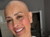 Melanie Sykes mostra com orgulho novo visible depois de perder cabelo ‘muito rapidamente’
