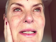 A estrela de Coronation Road, Tracy Shaw, ‘vulnerável quando um bebê’ após uma viagem ao pronto-socorro por causa de um efeito colateral horrível da quimioterapia
