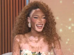 Winnie Harlow explica por que ela centrou seu novo livro infantil na autoconfiança