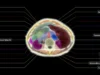 Midjourney está trabalhando em um scanner ultrassônico de corpo inteiro. Sério.