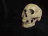 Cientistas acabam de reescrever a história de origem de uma das doenças mais mortais da humanidade