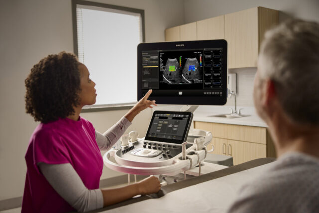 ultrasound_autoelastq-ALI-global-1260x840.jpg