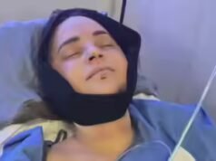 YouTuber Rosanna Pansino passa por cirurgia após quebrar mandíbula em acidente de barco