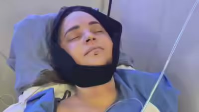 youtuber-rosanna-pansino-undergoes-surgery-after-breaking-jaw-in-boat-accident.jpg