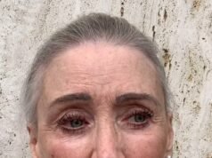 Angie Greatest, de 73 años, revela que tiene que someterse a una cirugía mayor mientras comparte información actualizada sobre su salud después de que le diagnosticaran cáncer de colon.