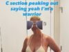 Amy Schumer muestra su pérdida de peso en bikini mientras revela por qué es una ‘guerrera’… después de volverse viral por criticar la boda de Taylor Swift