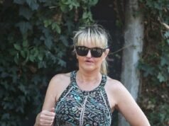 Danniella Westbrook revela los resultados de su última ronda de cirugía de reconstrucción facial mientras asiste al partido benéfico de Sellebrity Soccer.