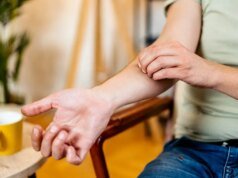 Por qué rascarse la picadura de un mosquito es mucho peor, según la ciencia
