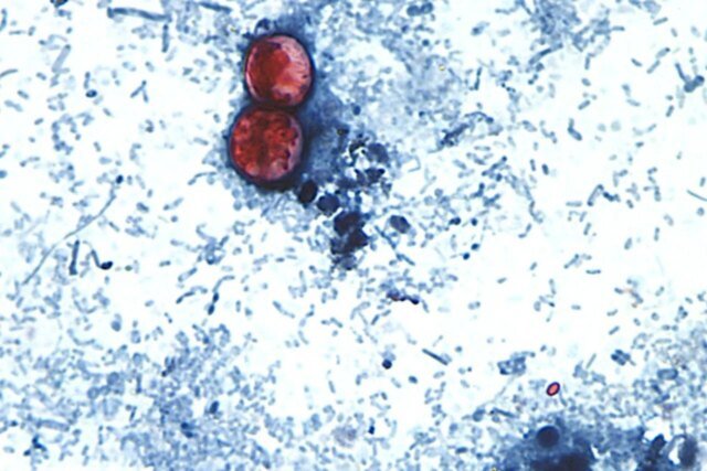 Cyclospora-1280x853.jpg