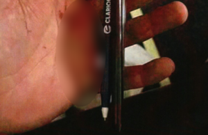 Un ciudadano mexicano hizo un cuchillo con bolígrafos e intentó apuñalar a un pasajero en el cerebro en un vuelo con destino a Las Vegas, cube el Departamento de Justicia