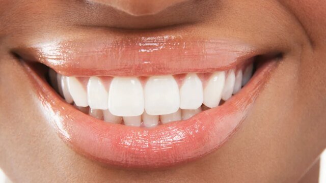 closeup-of-woman-smiling-with-perfect-white-teeth-by-mdbpixs-adobe-stock.jpg