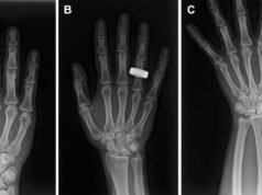 He aquí: las primeras radiografías médicas jamás tomadas en el espacio